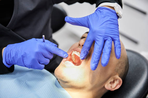 Best Emergency Tooth Extraction in Troy, OH